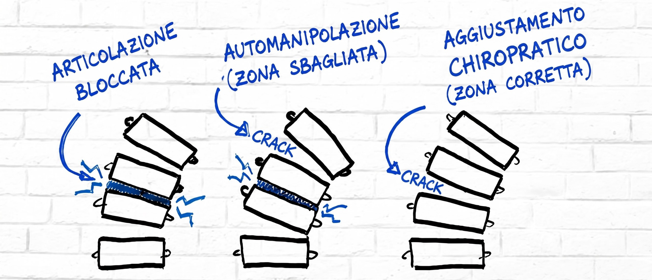 Lastra alla cervicale